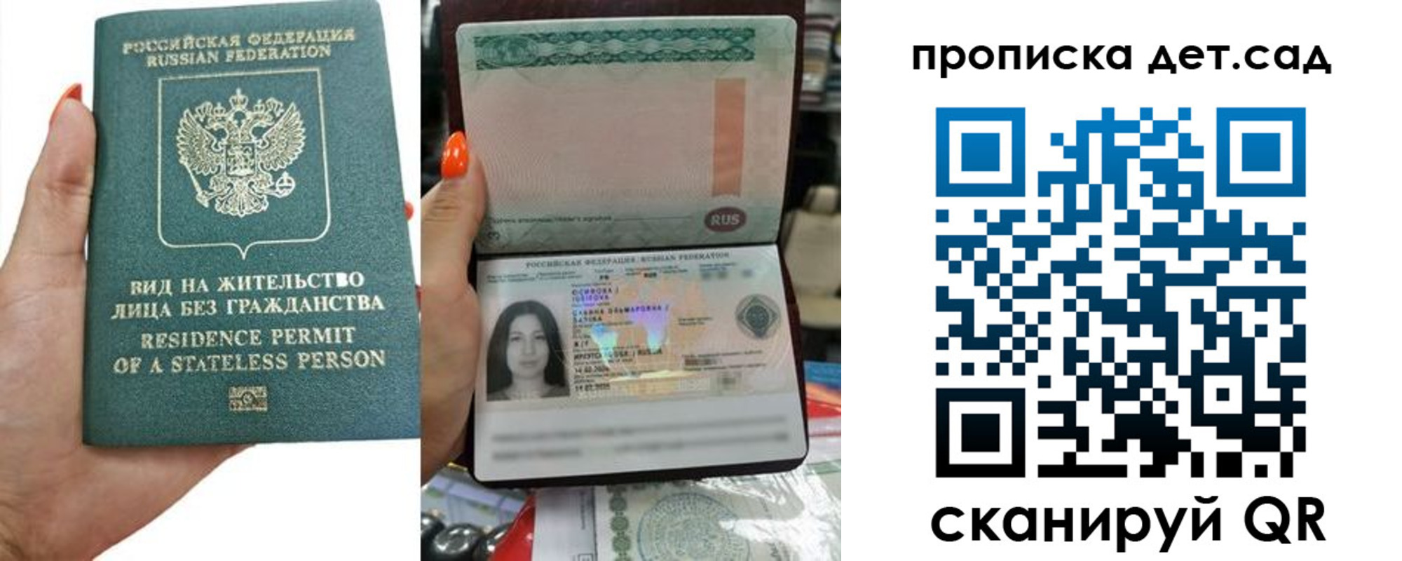 прописка в Козловке